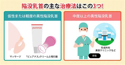 かす 乳首|陥没乳頭も原因？！乳首に溜まる白い垢の正体と汚れのケア方法。